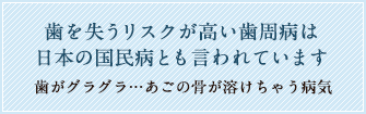 歯を失うリスクが高い歯周病は日本の国民病ともいわれています
